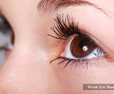 Weak Eye Muscles